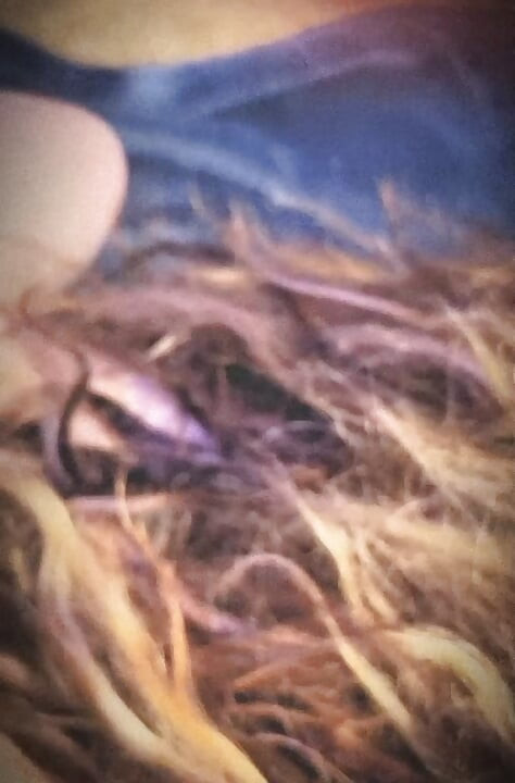 Fiancé Bashes Me From Behind