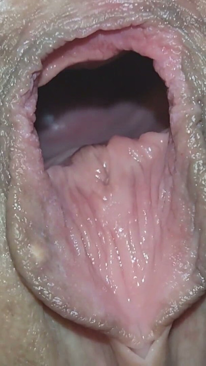 Cervix for Namsei (close-up) | Clip 1