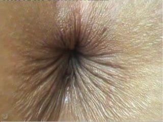 Close -up butthole knipogen