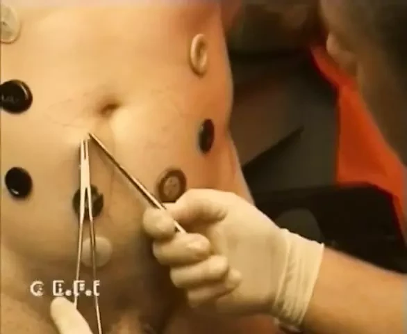 Screaming guy got sewn