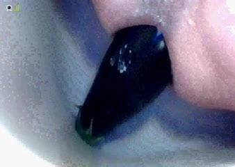 eggplant