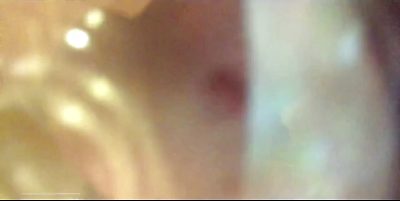 Close up, Cock Engorged in Tube 30 Plus Minutes