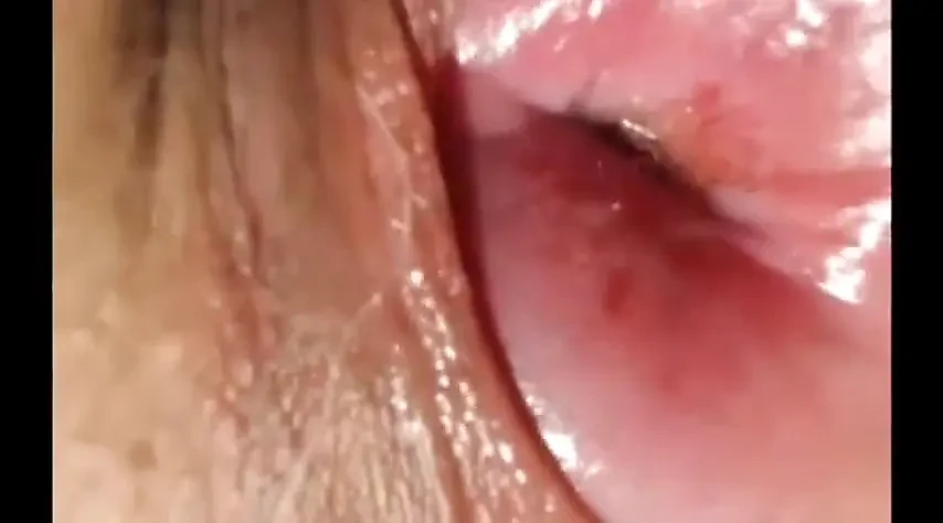 Long juicy cervix show close up,pencil