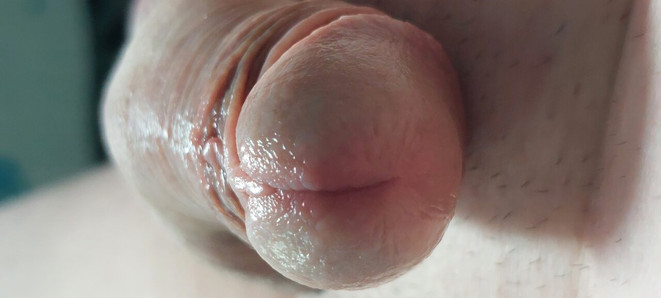 Penis vibro sperm üretral sondaj