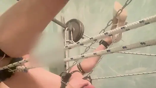 Banding no move anal