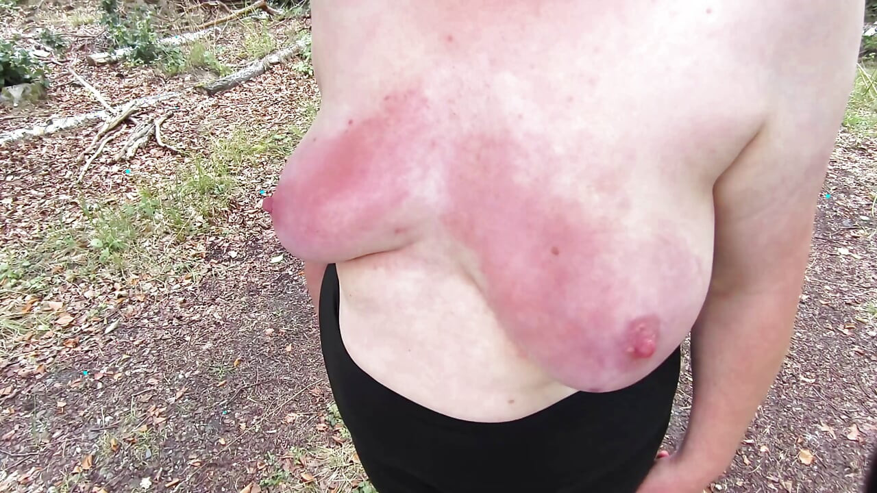 Barefoot beating your breasts red while hiking