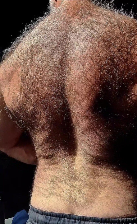 my HAIRY BACK
