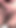 Stunning moment from "Close -up relieves orgasm of a girl's pussy"