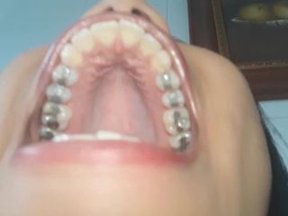 Sexy Latina Girl with Mouth Full of Fillings