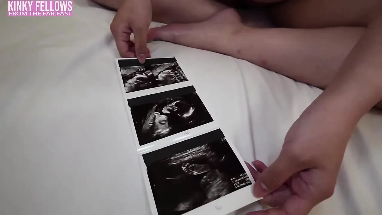 Can Desire Still Burn at 26 Weeks Pregnant? a J Cup Gravure Idol Dares a Risky Mini Uniform Fantasy
