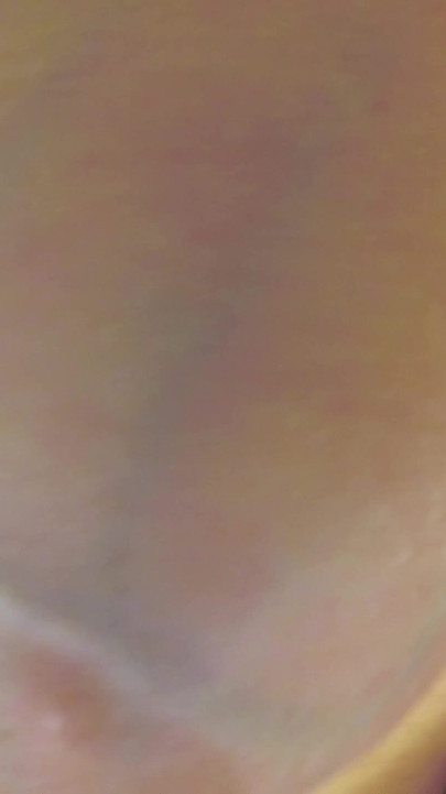 Kobe Lee - Jiggletron Vi