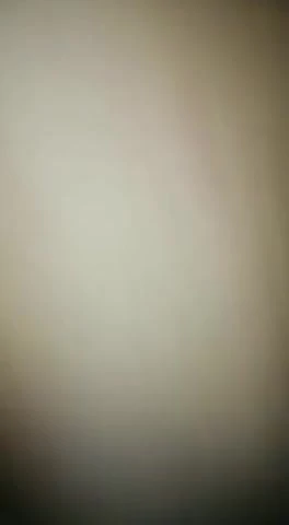 Anal