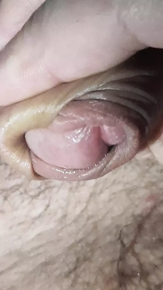 Foreskin play