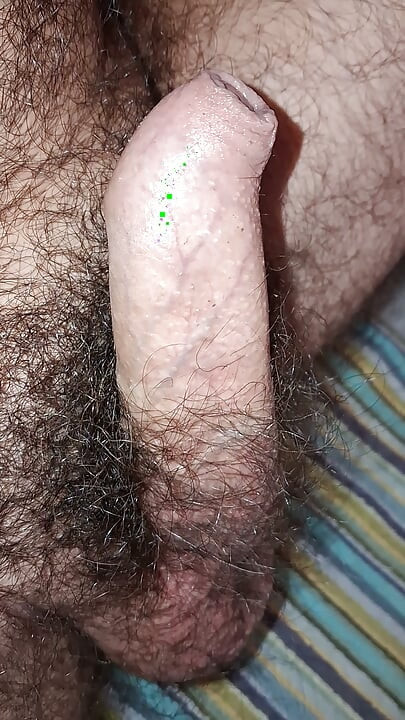 Large gland