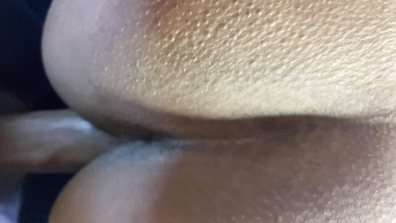 Pelo mms de pele viral