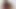 Lizzy Yum - Just Before Date BF Post-op Orgasm Pussy Clit Masturbation Teasing Orgasm