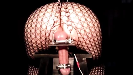 E-Stim 1