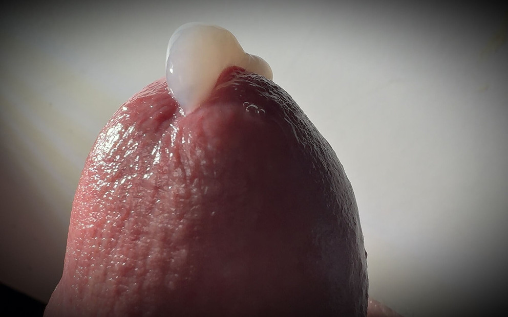 Penis damlatıyor