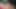 角質夫のお尻クソ妻に太陽