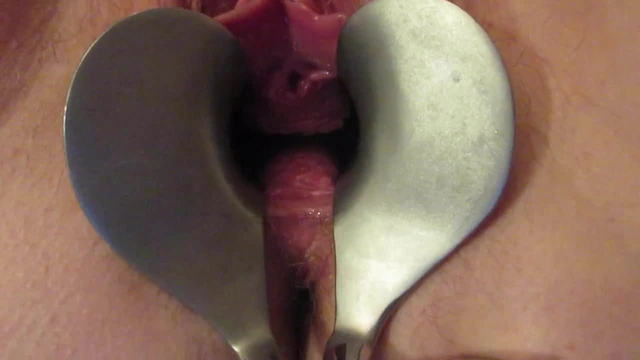 speculum insertion open pussy
