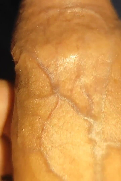 私のペニスを窒素で凍らせて、大きな勃起を得る。