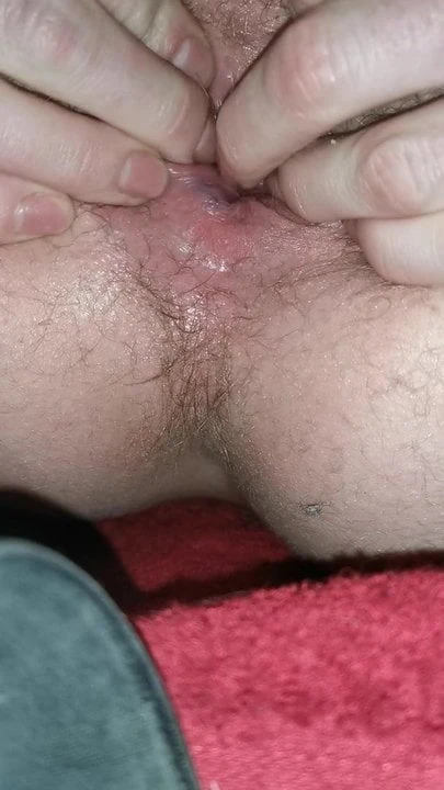 Close up to my tight prolapse anus.