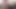March 1 2021 – Sylvia’s throat breakfast
