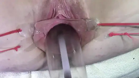 11 Weit Gespreizte Muschi Nahaufnahme Ficken Mit Lampe 1000 Watt