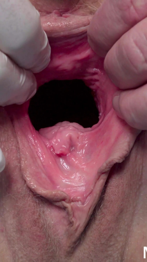 Medical examination of naked senior woman | Clip 2