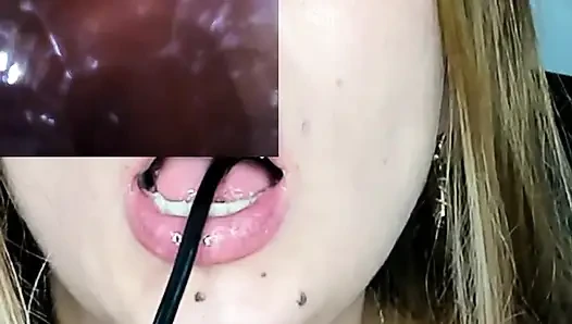 Endoskopi!! Giantess Menelan 25 Anggota Sekali lagi