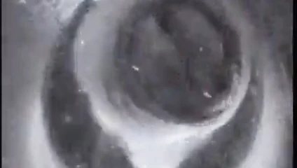 sperm bulutu