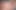 Karma Rx'in toplum amcığı var!