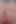 Anal fışkırtma çiş osuruk boşalması