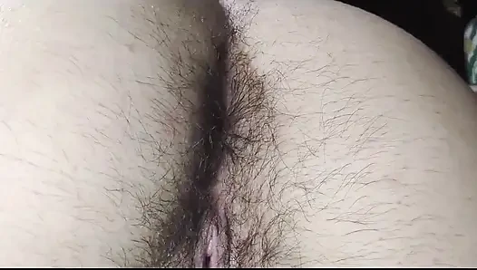 An Extreme Close-up of a Super Hairy Butt. I Haven't Cleaned Myself up Very Well, It Seems