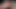 Big Uncut Phimosis Cock Solo. Precum Leaking, Tight Foreskin Tease,head Fetish and a Strong Finish