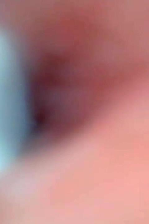 Endoscope Camera Captures Moment of Male Ejaculation 4K