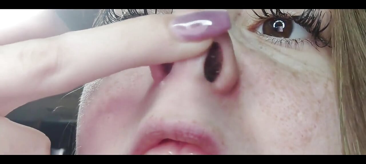 נזלת בתקריב