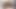 Bu insan kırkayak mı yoksa 3 başlı bir canavar mı?
