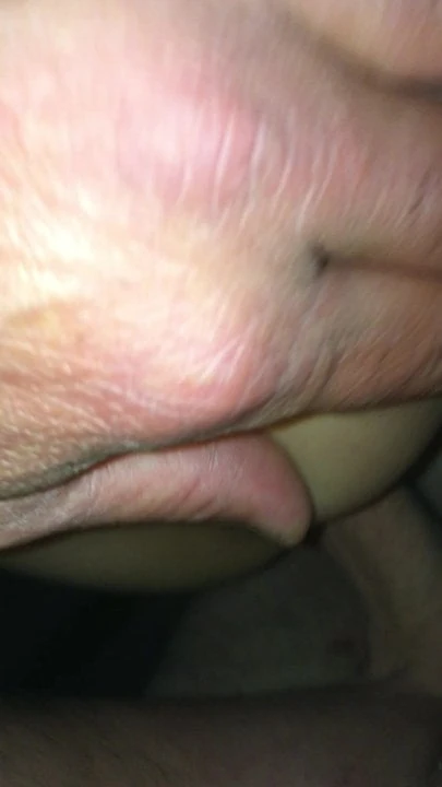 Double vaginal