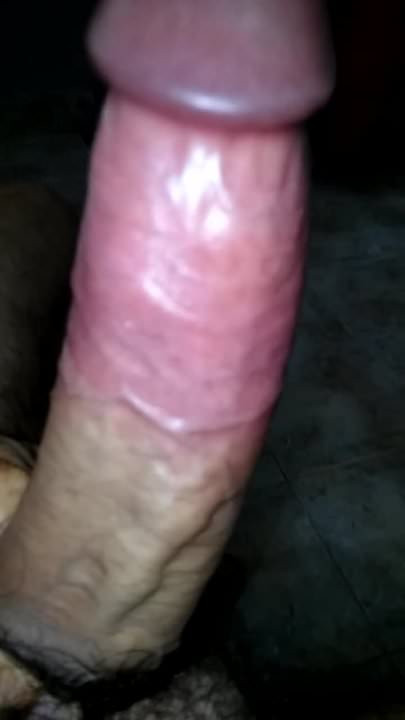 Verga de ereccion prolongada