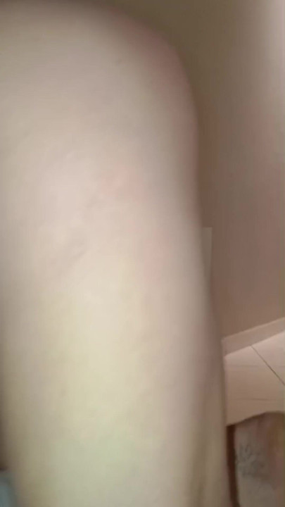 Coño loco