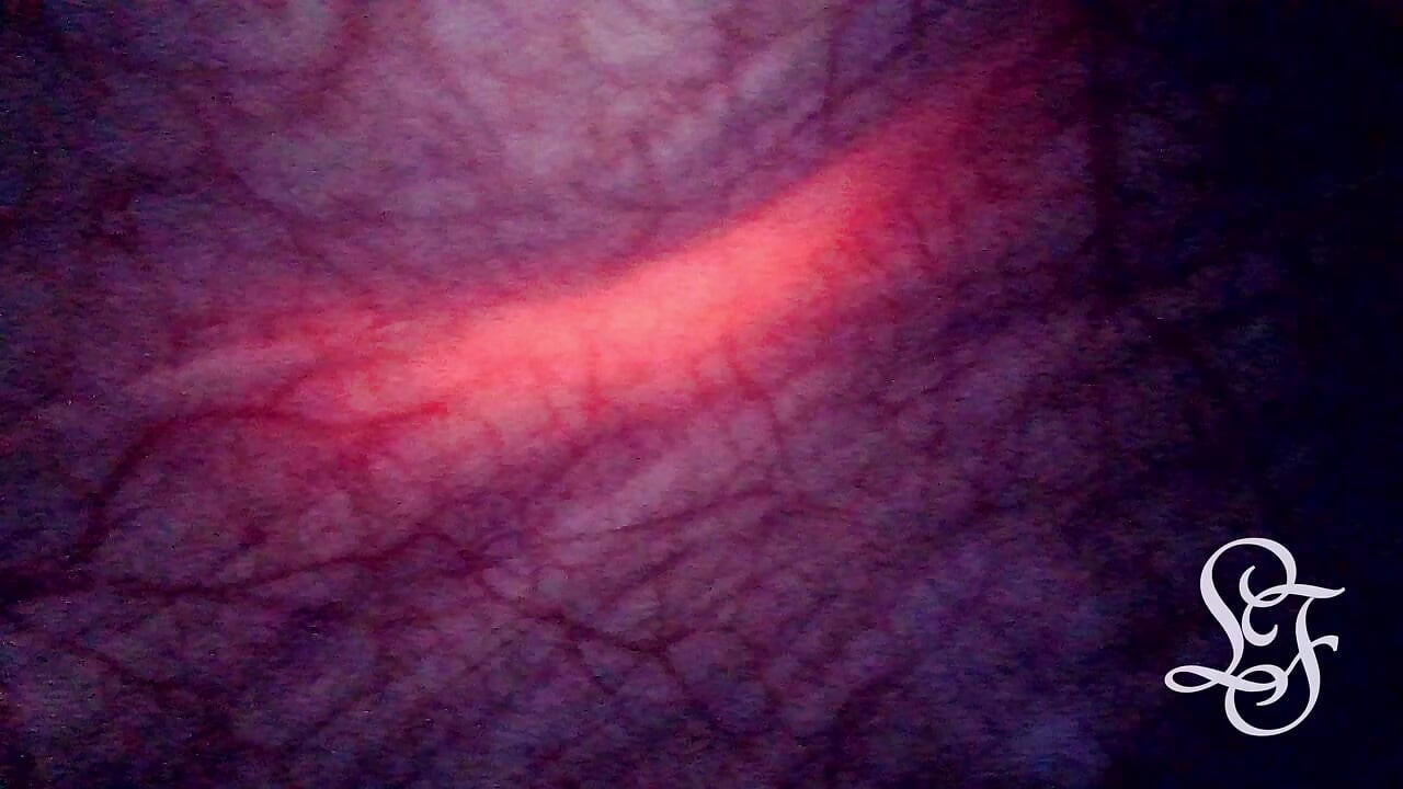 Assistindo minha ventre cheia de saliências para fora da minha barriga