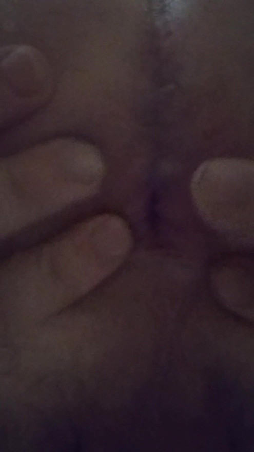 My ass hole