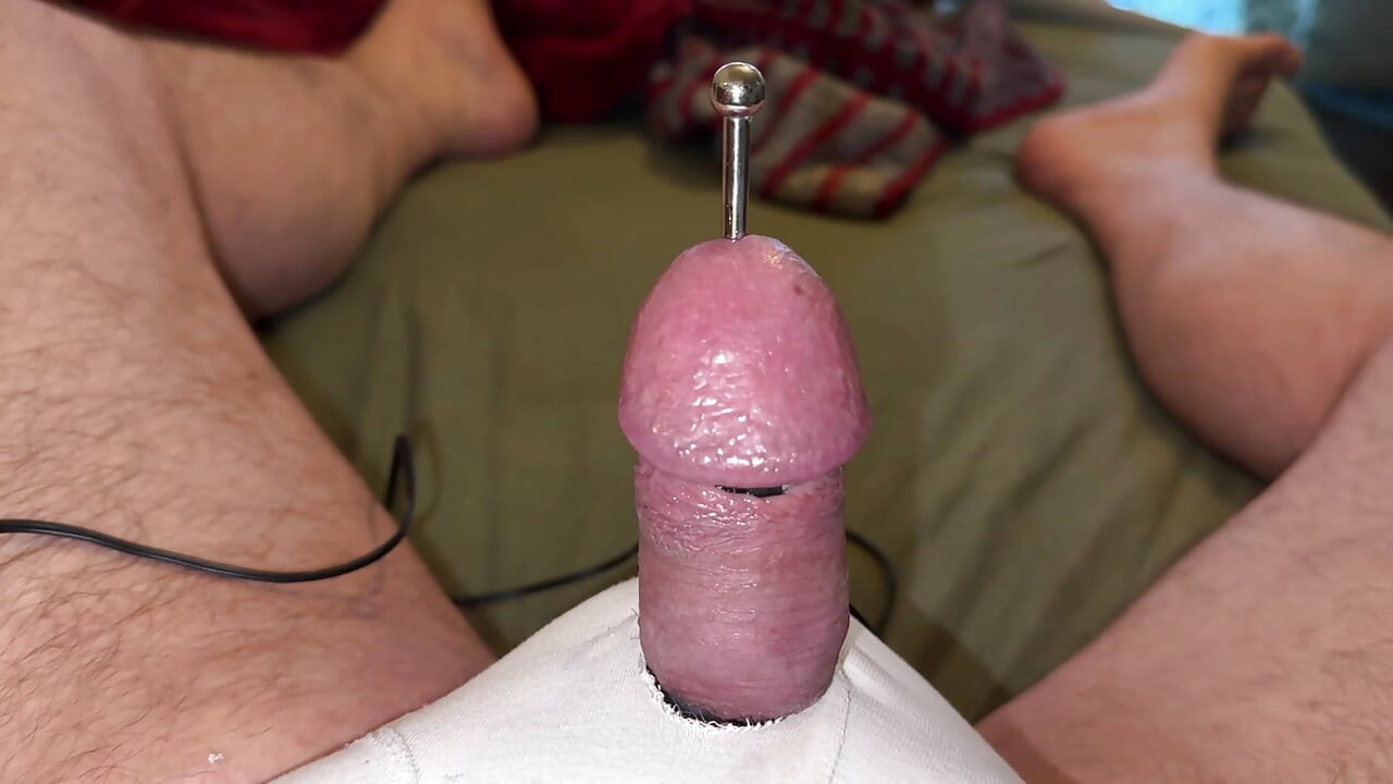 ¡acupuntura - ¡orgasmo!