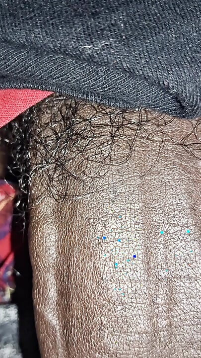 Close up on These Thick Veins