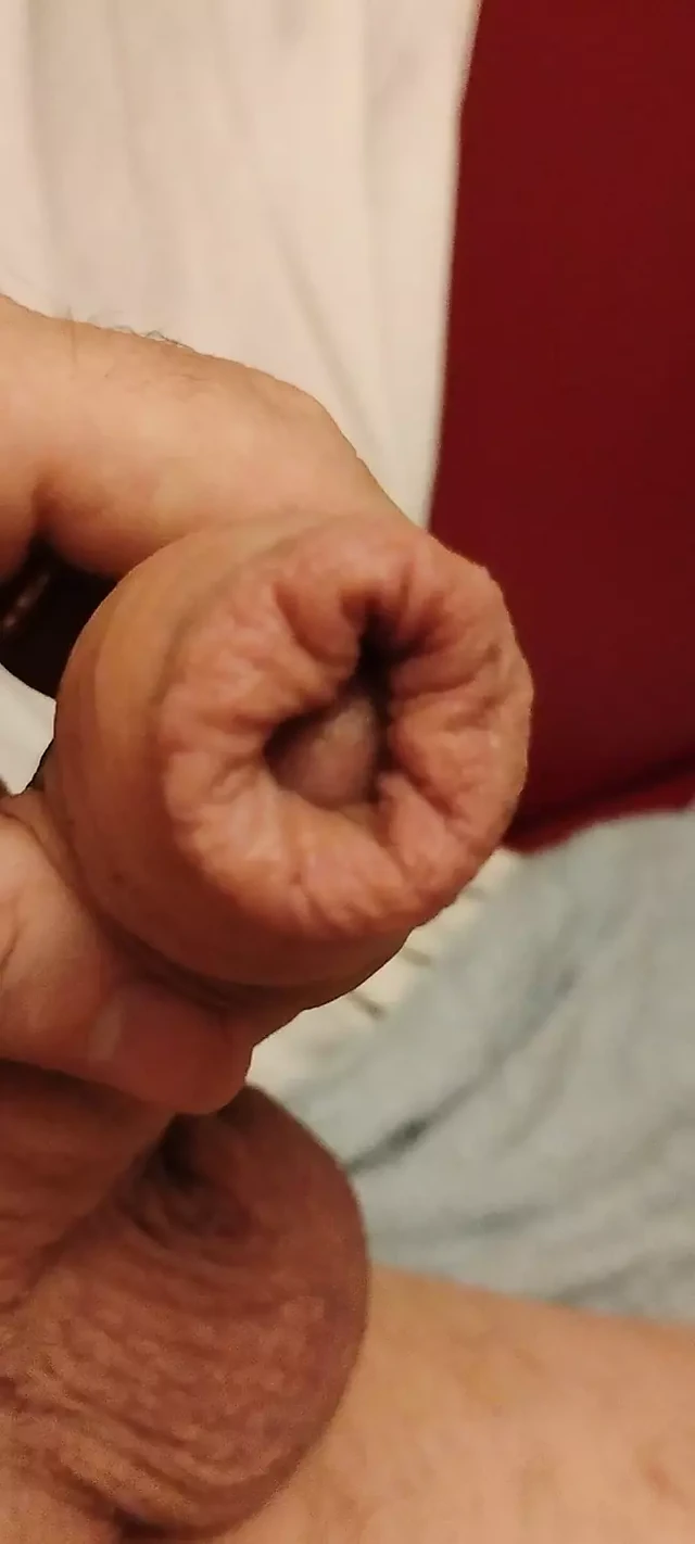 foreskin shower