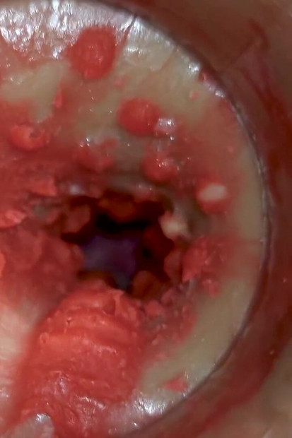 Camera Inside Deep Pussy Captures Huge Ejaculation of Sperm 4K