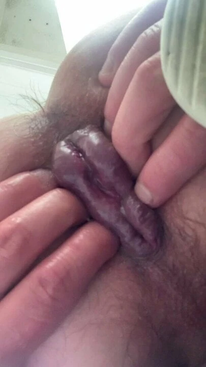 My Pussy Ass Play , Open Ass Prolapss