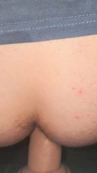 Anal masturbation