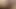 Teaser Pleaser